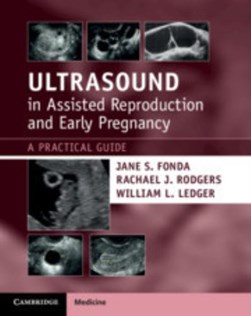 Ultrasound in assisted reproduction and early pregnancy by Jane S. Fonda