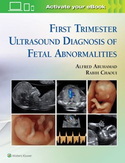 First trimester ultrasound diagnosis of fetal abnormalities by Alfred Abuhamad