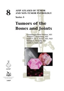 Tumors of the bones and joints by G. Petur Nielsen