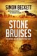 Stone bruises by Simon Beckett