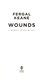 Wounds P/B by Fergal Keane