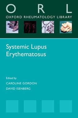 Systemic lupus erythematosus by Caroline Gordon