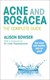 Acne & Rosacea Tpb by Alison Bowser