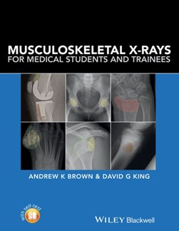 Musculoskeletal X-rays for medical students and trainees by Andrew K. Brown