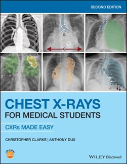 Chest X-rays for medical students by Christopher Clarke