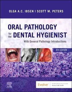 Oral pathology for the dental hygienist by Olga A. C. Ibsen