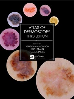 Atlas of dermoscopy by Ashfaq A. Marghoob