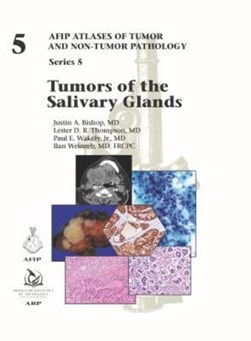 Tumors of the salivary glands by Justin A. Bishop
