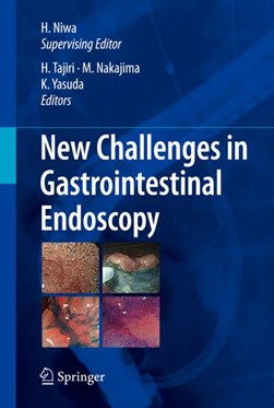 New challenges in gastrointestinal endoscopy by H. Niwa