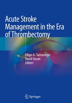 Acute Stroke Management in the Era of Thrombectomy by Edgar A. Samaniego
