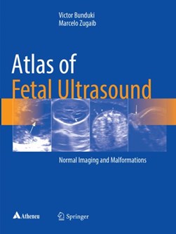 Atlas of Fetal Ultrasound by Victor Bunduki